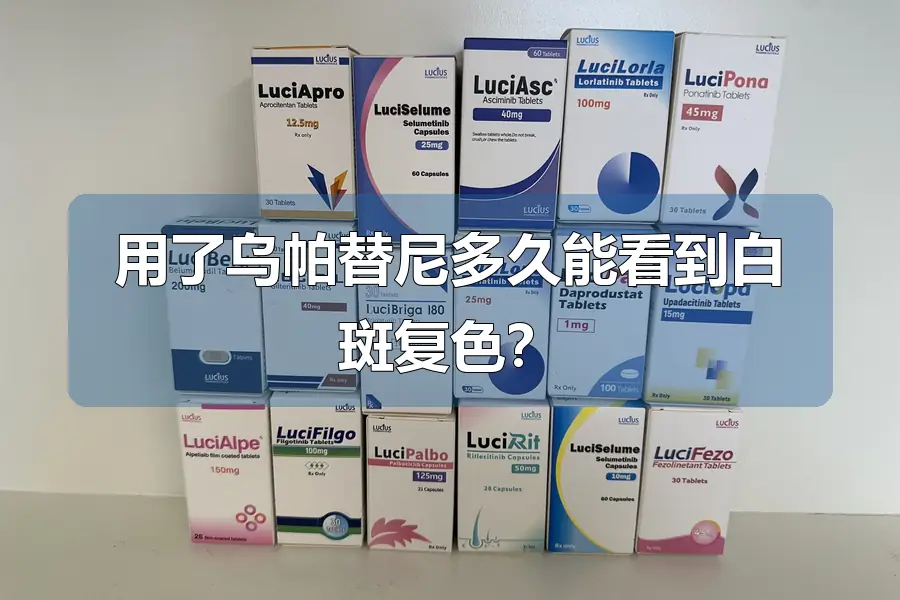 用了乌帕替尼多久能看到白斑复色?