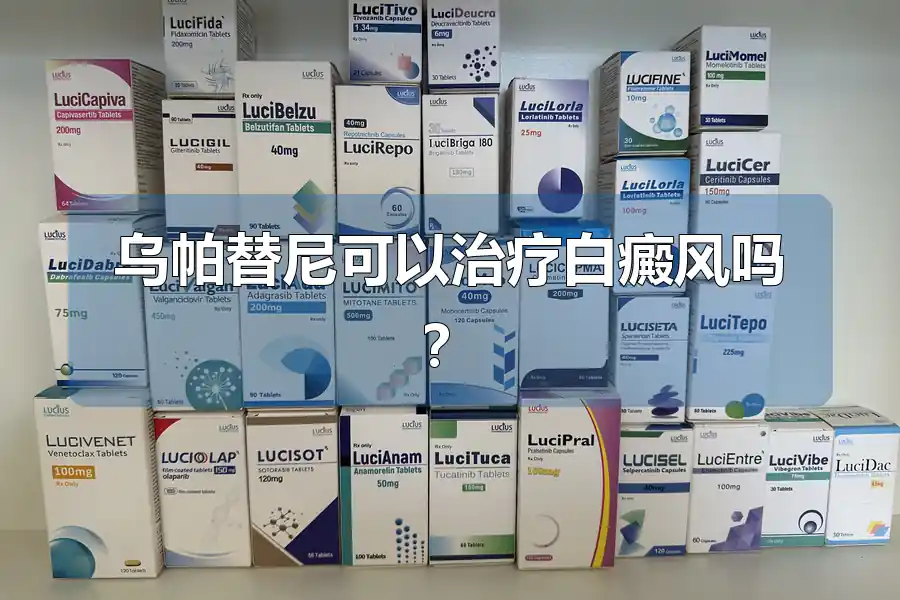乌帕替尼可以治疗白癜风吗?